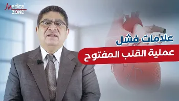 علامات فشل عملية القلب المفتوح